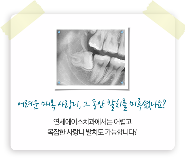 어려운 매복 사랑니, 그 동안 발치를 미루셨나요? 연세에이스치과에서는 어렵고 복잡한 사랑니 발치도 가능합니다!