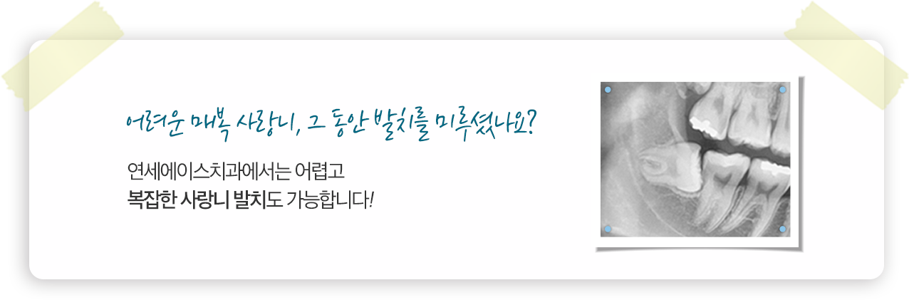 어려운 매복 사랑니, 그 동안 발치를 미루셨나요? 연세에이스치과에서는 어렵고 복잡한 사랑니 발치도 가능합니다!