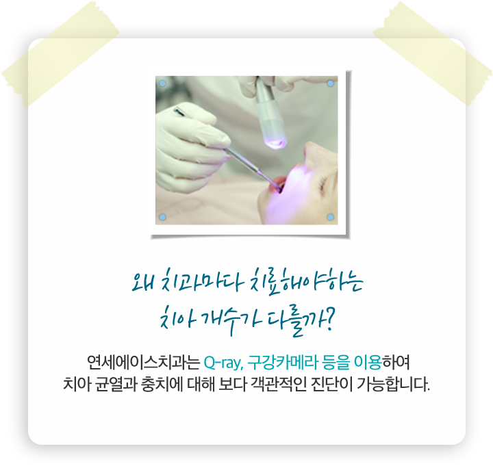 왜 치과마다 치료해야하는 치아 개수가 다를까? 연세에이스치과는 Q-ray, 구강카메라 등을 이용하여 치아 균열과 충치에 대해 보다 객관적인 진단이 가능합니다.